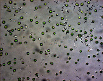Microcystis aeruginosa (mynd Friðbjörn Möller)